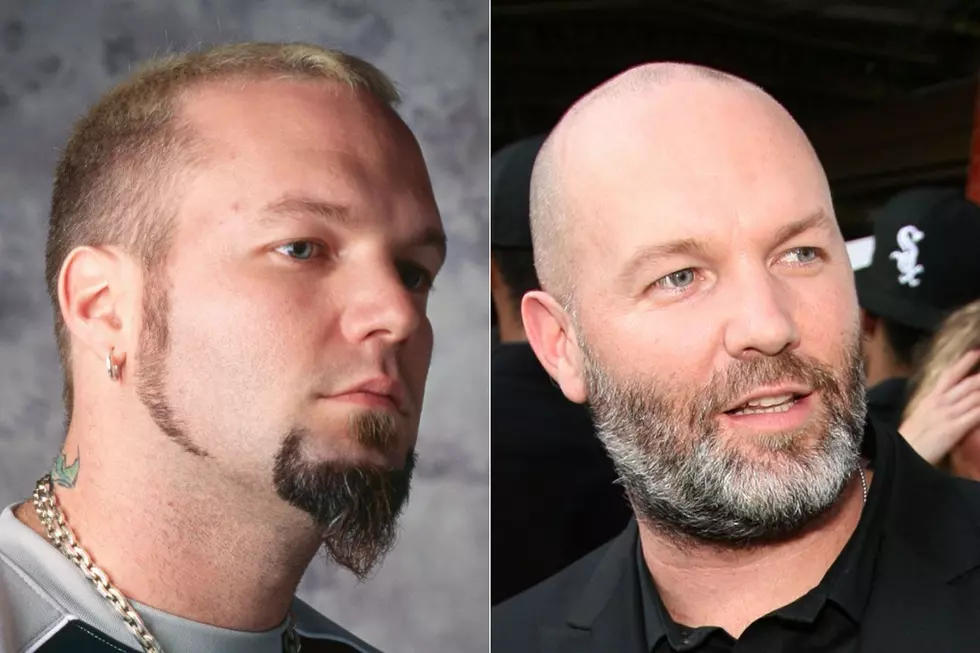 Bald Rockers - Before and After Photos (Singers Edition)